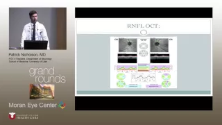 Central Serous Retinopathy vs Optic Neuritis: Treatment Implications