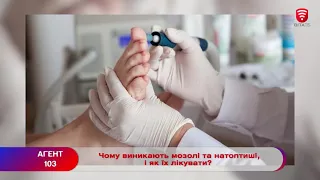 МОЗОЛІ ТА НАТОПТИШІ. Чому виникають, як лікувати?