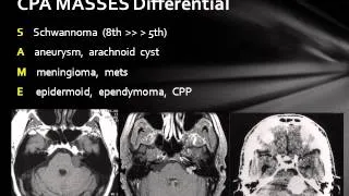 Cerebellopontine Angle Lesions