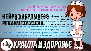 Нейрофиброматоз Реклингхаузена