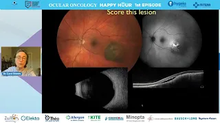 Uveal Melanoma 2022 | C. Shields