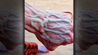 "Bros Got Alien Veins..." 🤦‍♂️