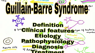 Guillain-Barré Syndrome | Explained In Hindi | Causes, Pathophysiology, signs & symptoms