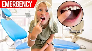 i BROKE MY TOOTH!! EMERGENCY!!