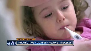 Doctors: Vaccinations could have prevented return of measles