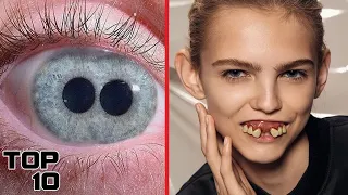 Top 10 Strangest Human Mutations That Doctors Can't Explain