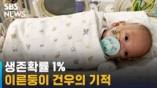 생존확률 1%…23.5cm · 288g 이른둥이 건우의 기적 / SBS