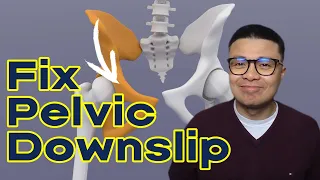 How to correct a Pelvic Downslip