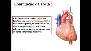Cardiopatia Congênita - Profª Meliza Goi Roscani