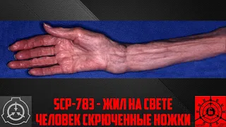 SCP-783 - Жил на свете человек Скрюченные ножки       【СТАРАЯ ОЗВУЧКА】