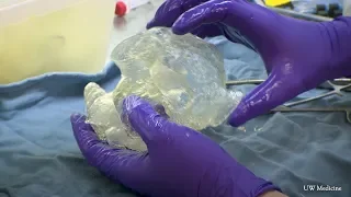 Personalized care, with 3D-printed heart models