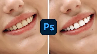How to Whiten Teeth in Photoshop — Adobe Photoshop 2023 New Features!