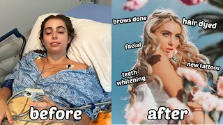 Glowing up after Surgery transformation