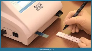 SARS-CoV-2 Antibody Test using the Wellion INOVO FIA Analyzer & Wellion SARS-CoV-2 Total Ab Testkit