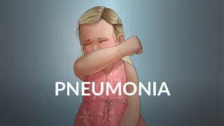 "Pneumonia" by Brian Fissel and Dr. Patricia Stoeck