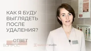 ЛАЗЕРНОЕ УДАЛЕНИЕ ТАТУАЖА БРОВЕЙ. Как удалить татуаж без негативных последствий?