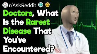 Doctors, What's the Rarest Disease You've Diagnosed?