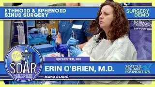 Ethmoid & Sphenoid Sinus Surgery - Erin O’Brien, M.D.