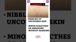 #categories of animal bite