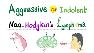 Aggressive VS Indolent Non-Hodgkin's Lymphoma