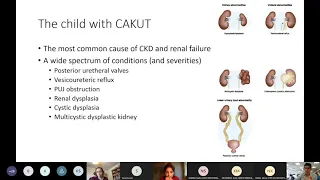 MRCPCH Clinical Exam Teaching - Renal