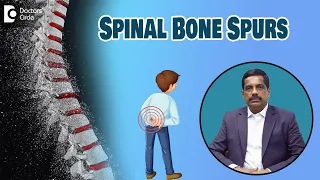 Spinal Bone Spurs - Symptoms & Treatment| Osteophytes - Dr. Kodlady Surendra Shetty| Doctors' Circle