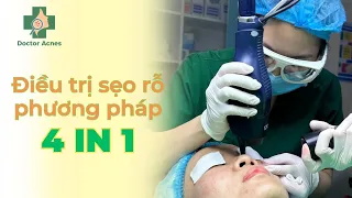 DOCTOR ACNES - BÍ KÍP ĐIỀU TRỊ SẸO RỖ TẠI DOCTOR ACNES