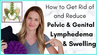 How to Get Rid of Pelvic or Genital Swelling- Treatment Options for Lymphedema