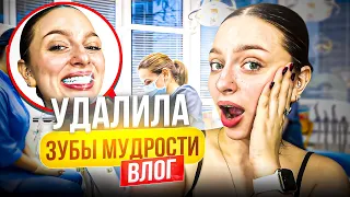 УДАЛИЛА ЗУБЫ МУДРОСТИ vlog