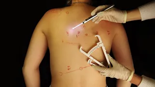 ASMR | REAL BACK INSPECTION (mapping + treatment)
