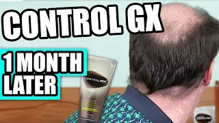 Control GX- One Month Follow Up