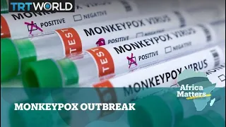 Africa Matters: Monkeypox Outbreak