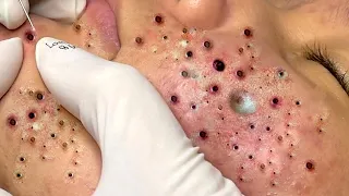 Satisfying Relaxing With NaSa Spa #542