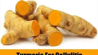 Top 6 Natural Cures For Cellulitis