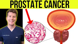 What is PROSTATE CANCER? Doctor explains SIGNS, SYMPTOMS, TREATMENT and more!
