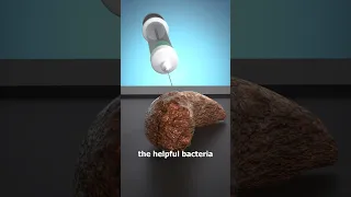 How A Poop Transplant Works 💩🤔