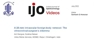 A 28-mm intraocular foreign body removal: The vitreoretinal surgeon’s dilemma