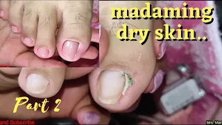 Vlog 346|Dry Skin/Ingrown Removal| PEDICURE 246