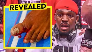 UFC Most BRUTAL Injuries Revealed...