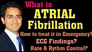 ATRIAL FIBRILLATION (AFIB) TREATMENT, ECG INTERPRETATION, PATHOPHYSIOLOGY, AFIB MANAGEMENT LECTURE