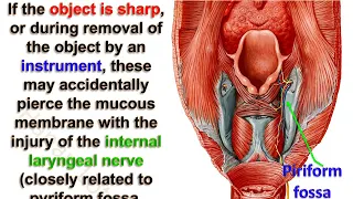 Anatomy of pharynx (show only)