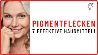 ✅7 HAUSMITTEL DIE PIGMENTFLECKEN IM GESICHT ENTFERNEN✅ Was hilft wirklich bei Pigmentflecken?