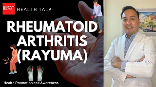 What is Rheumatoid Arthritis (Rayuma)? Causes, Symptoms, Treatment & Prevention