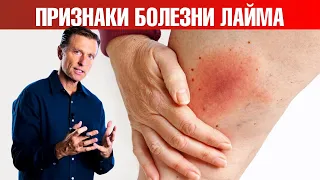 Первые симптомы болезни Лайма (боррелиоз) 👉 что делать?