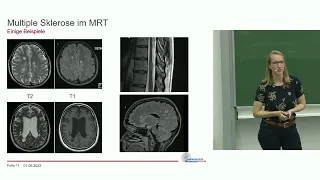 Patient*innenveranstaltung Multiple Sklerose 2022 | MS im Überblick