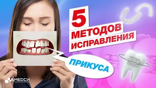 Как в России исправляют зубы. Методы исправления прикуса // #медси #брекеты #ортодонтия