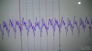 Identifying a misfire with pico