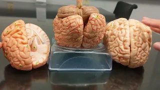 Brain Anatomy | Review and Practice 2