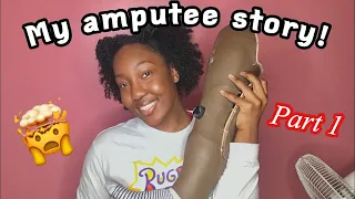 My Amputee Story part. 1 || Itsjustebby