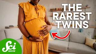 Can You Really Get Pregnant...While Already Pregnant? | Superfetation Explained